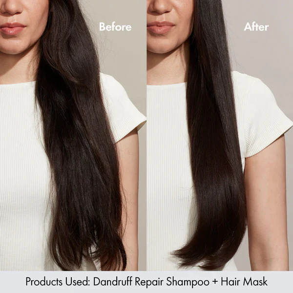BONDI BOOST Dandruff Repair Hair Mask - Image 2