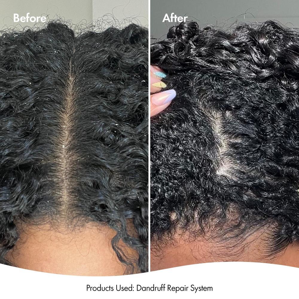 BONDI BOOST DANDRUFF REPAIR LEAVE IN SCALP SERUM 125ML - Image 3