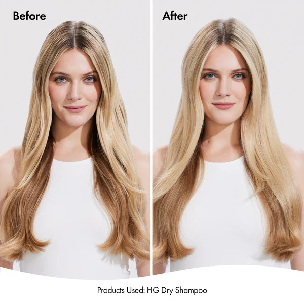 BONDI BOOST HAIR GROWTH DRY SHAMPOO 200ML - Image 3